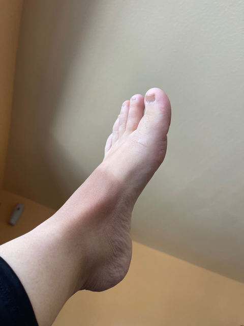 @uglyfeet1000