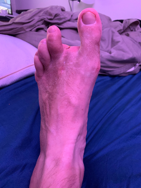 @andysfoot