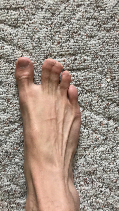 the_webbed_toes nude