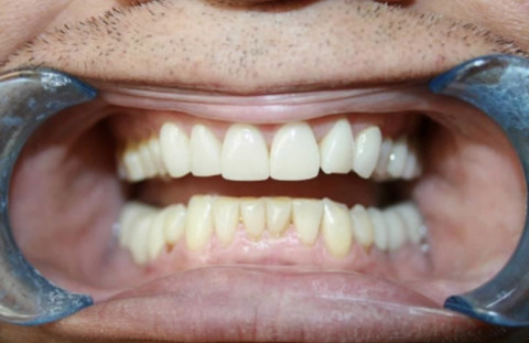 ToothFetish Doc profile picture