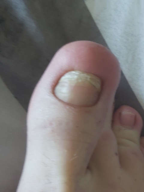 Toes Amongst Us profile picture