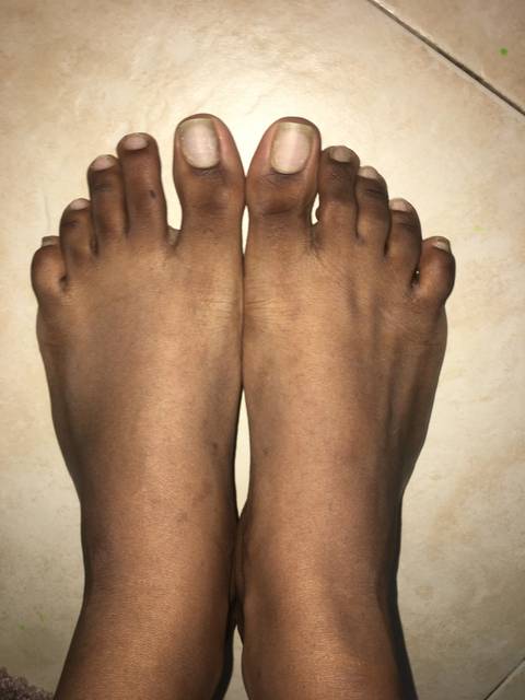 bareebonyfeet