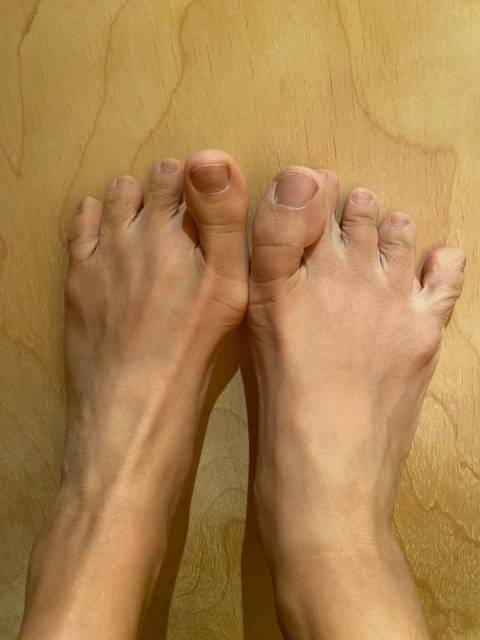 superuglyfeet