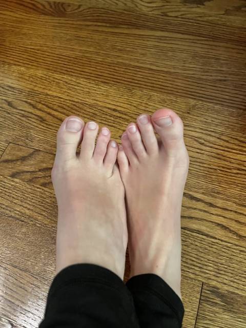 @toegirlthings