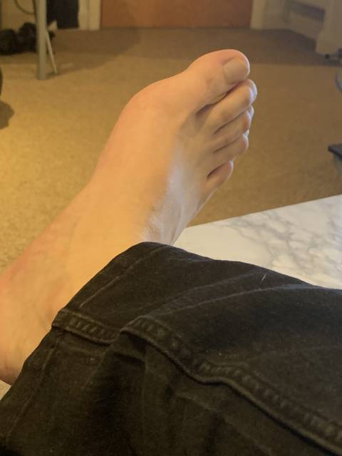 @feet_ner-on