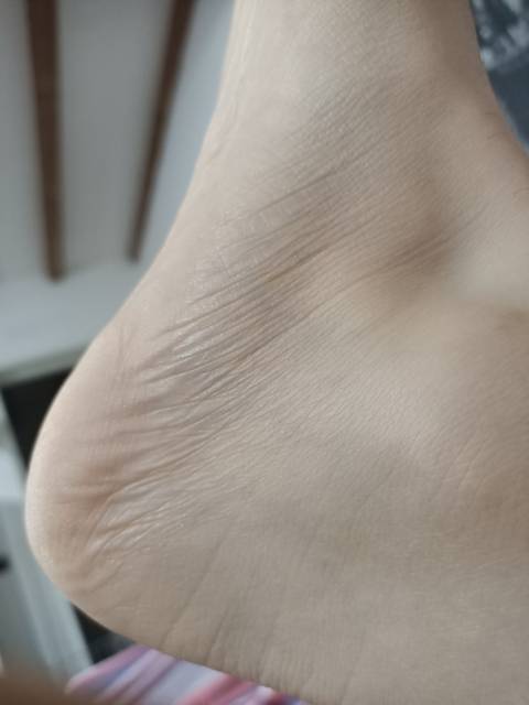 piediperfeticisti