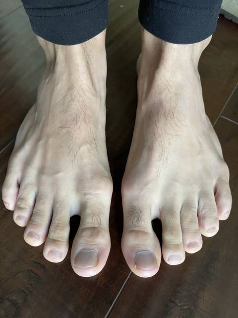 feetsolesntoes