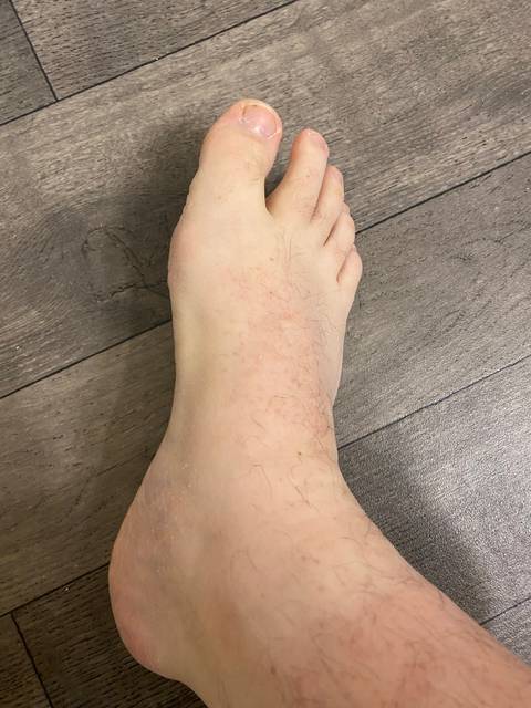 @hobbitfeetpics91