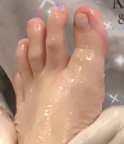 candyxxxtoes