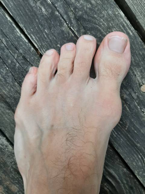 @misternicefoot