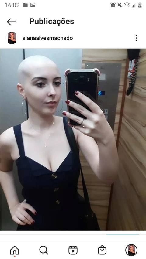 @baldhot