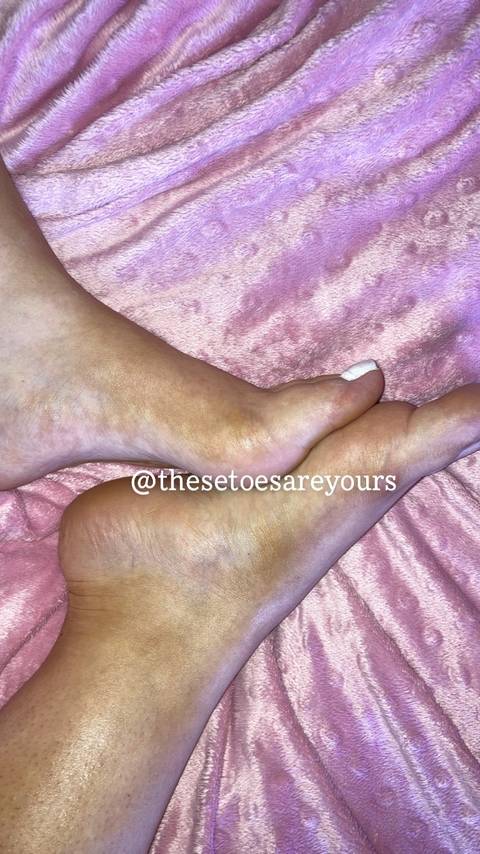 @thesetoesareyours