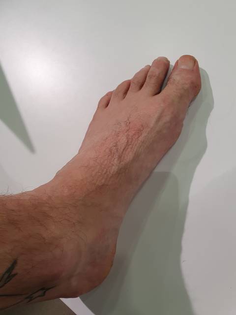 dudefoot