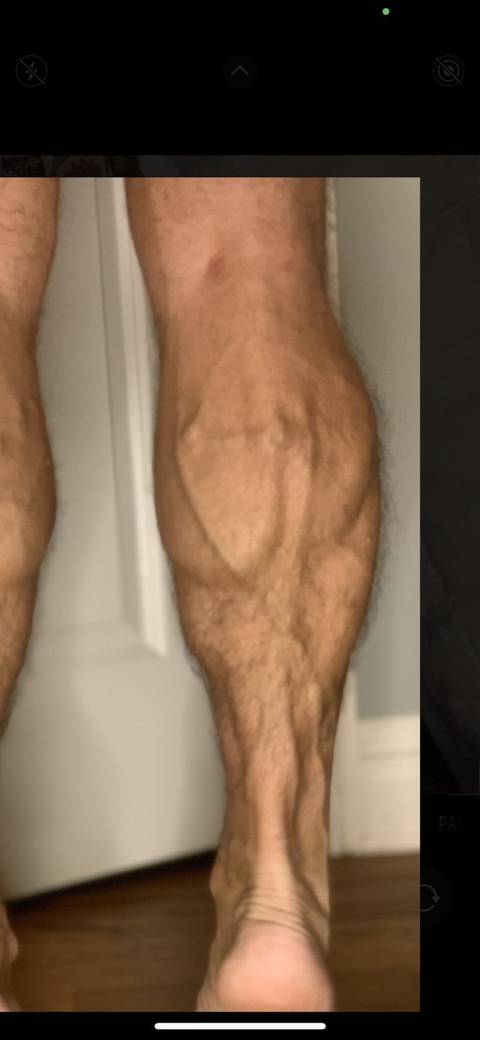 mr.calves