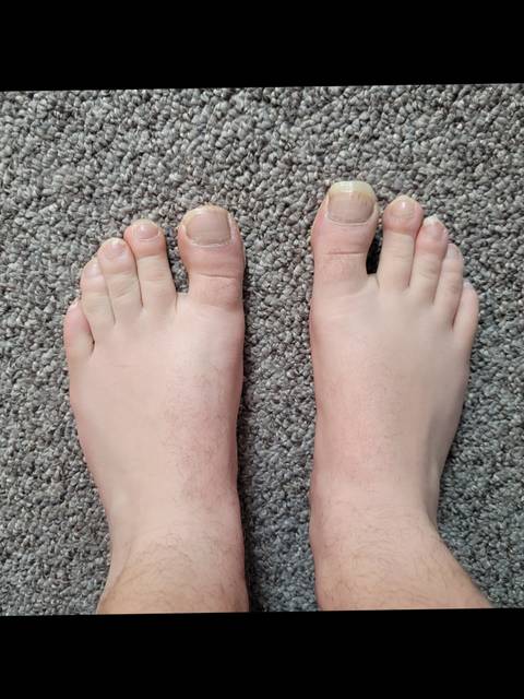 bigbigtoes nude