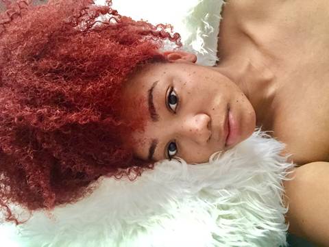 frecklesforsale