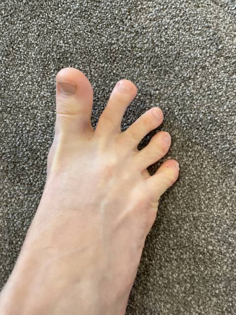 freakfeet69