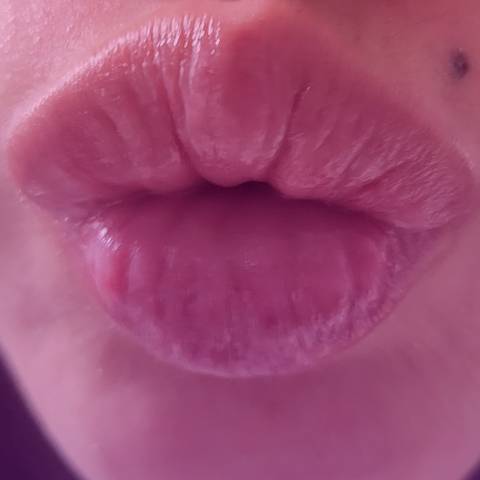 lipsbae