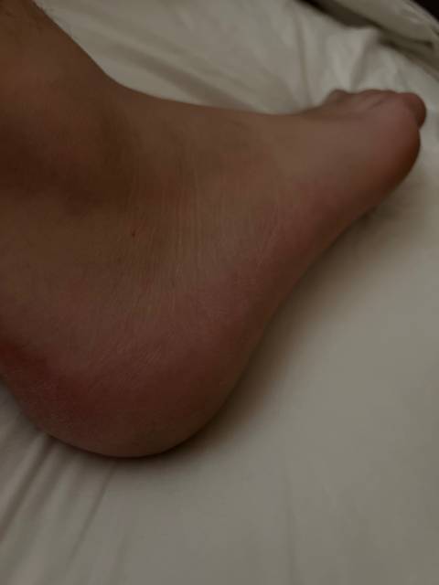 aussieboyfeetncock nude