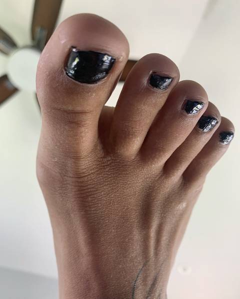 fugly-feet