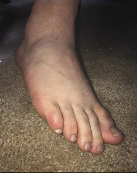 @petesmanfeet