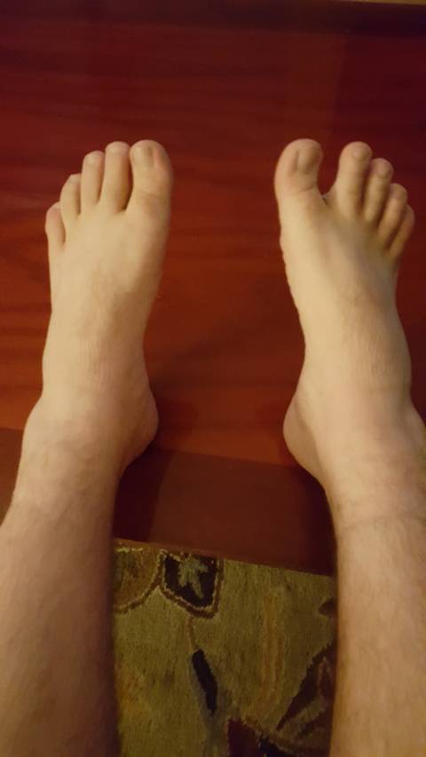 ringaroundmytoesie