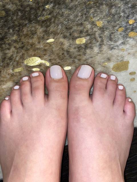 @exotictoes3315