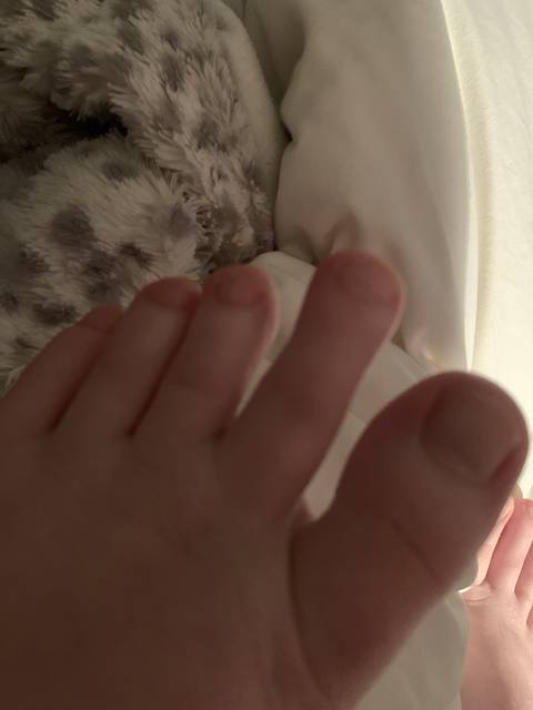 w3irdfeets nude