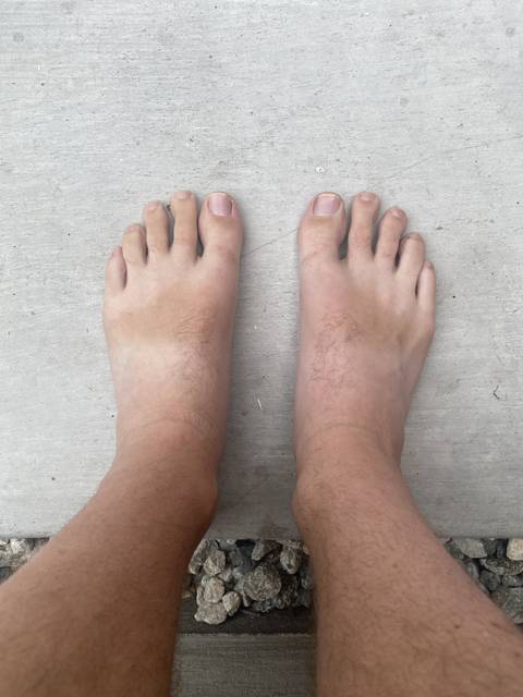 @guywithfeetandtoes