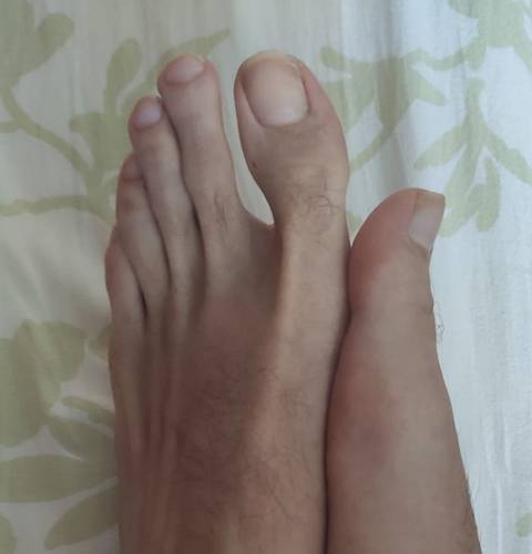 see_myfeet