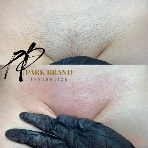 @parkbrand