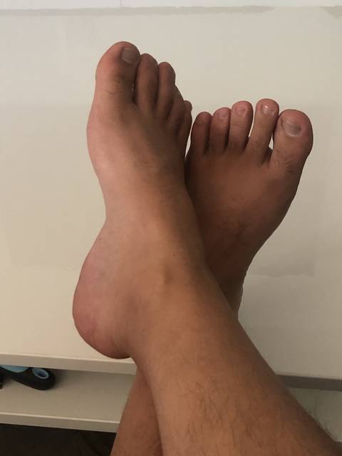 theticklersfeet