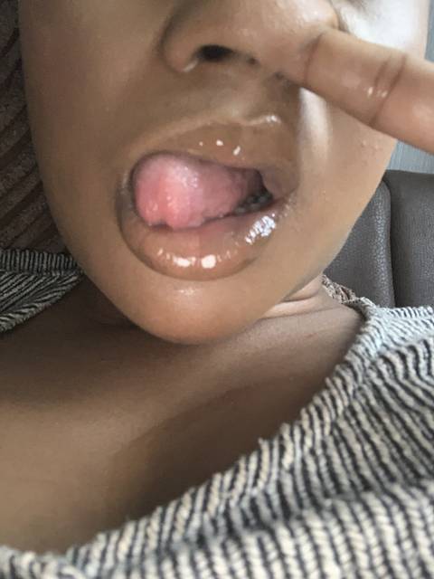 rfuqmynose