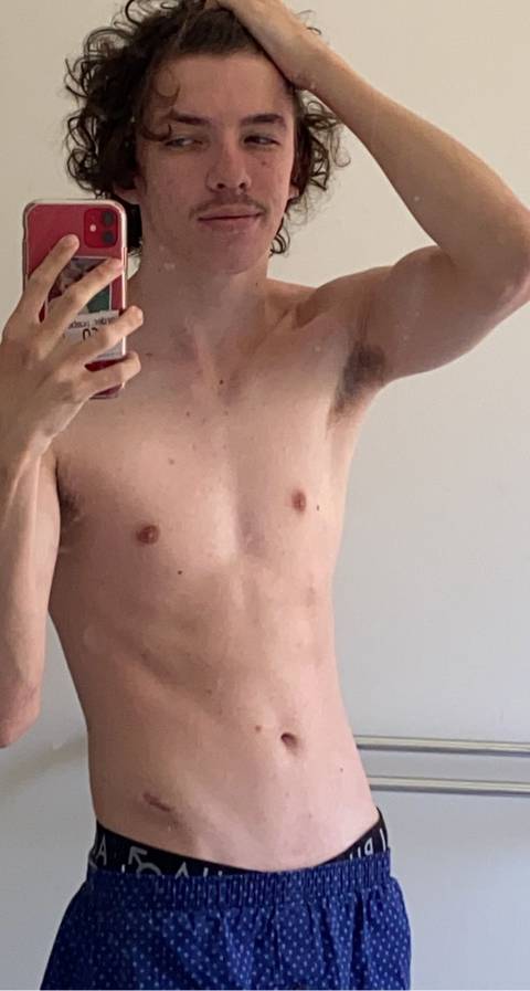 @plaguebait @plaguebait