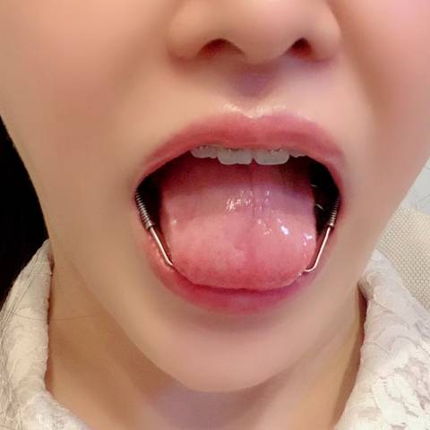 @nonchan @nonchan