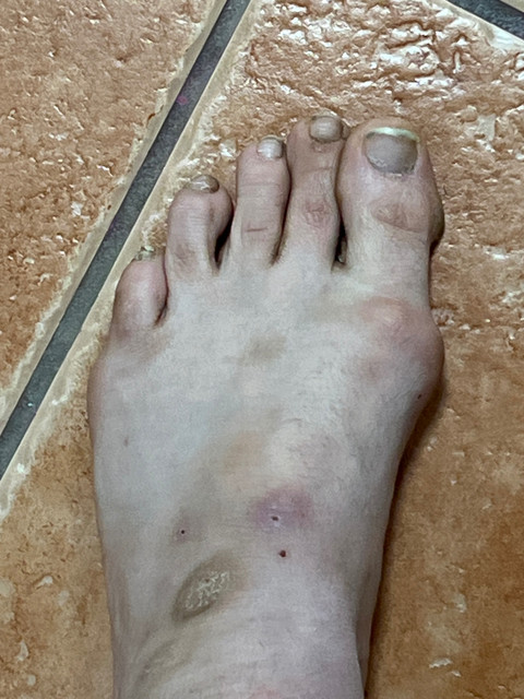 F*cking Disgusting Feet profile picture