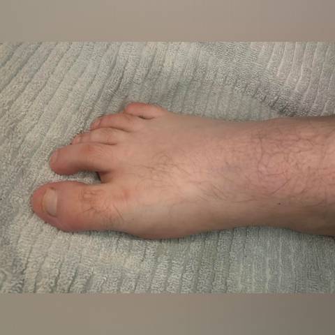 @foot.crush.of nude foot.crush.of nude