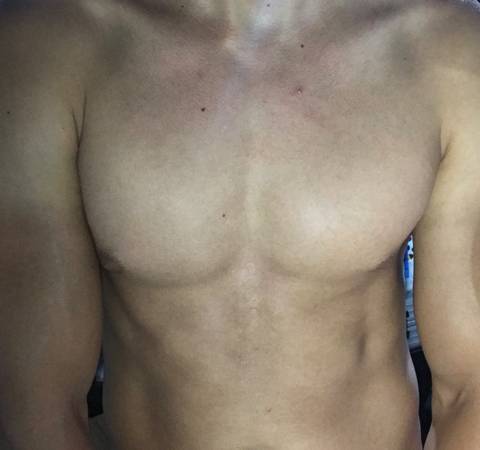@excito @excito
