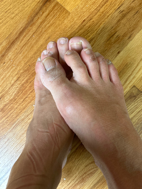 BrokenFeet profile picture