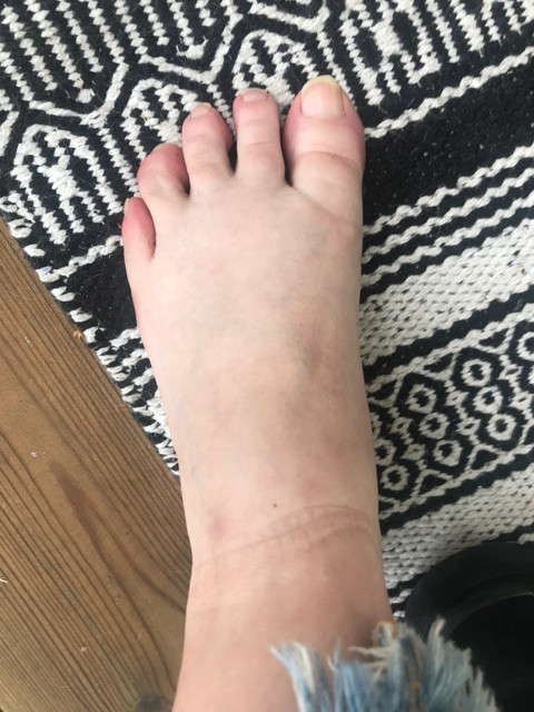 Feetfinn profile picture