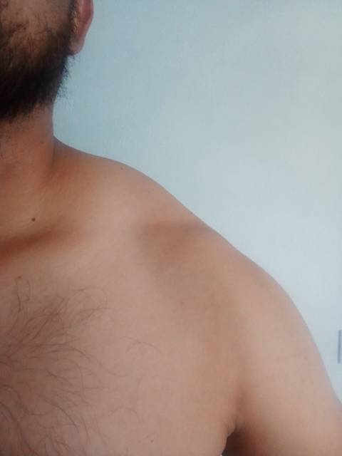 @erncastillo @erncastillo