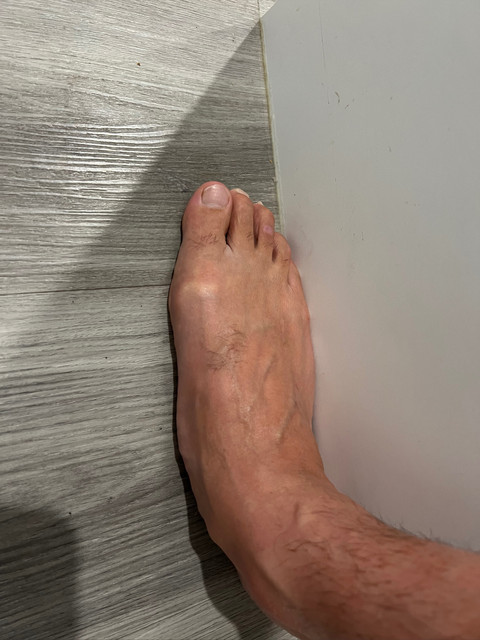 flatfeet profile picture