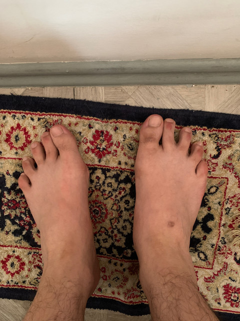 Ugly feets profile picture