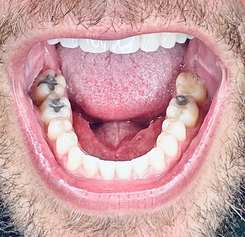 Bigoleteeth14 profile picture